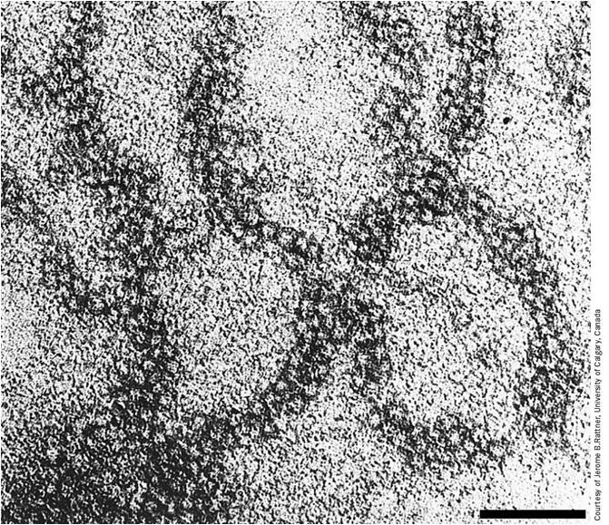 Cromatina: livelli di organizzazione più elevati - l avvolgimento del DNA sul singolo nucleosoma