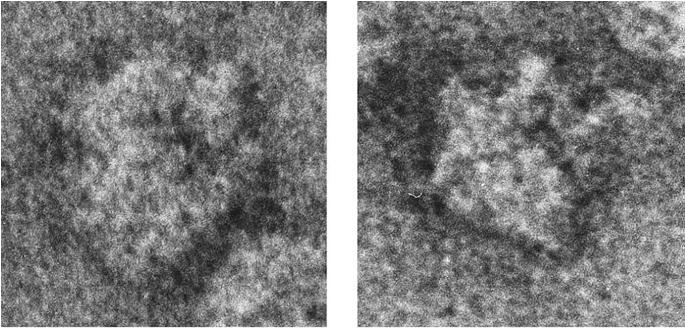 4 Å) della subunità 50S del batterio alofilico Haloarcula marismortui (~10 6 atomi) - struttura cristallografica (~3.0 Å) della subunità 30S del batterio T.