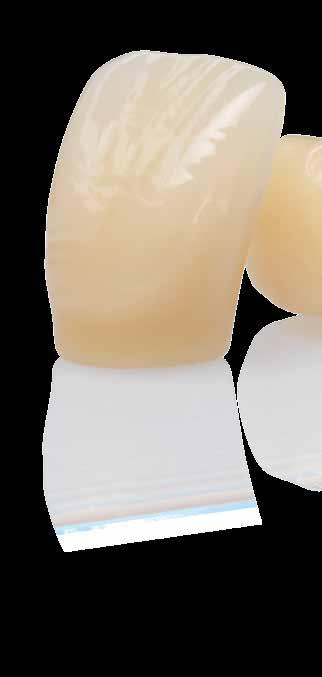 Secondo il mastro odontotecnico Rudolf Wohlgenannt le forme della nuova linea denti hanno acquisito attrattività.
