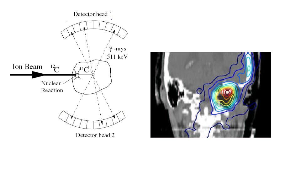 I costi sono ancora molto elevati, sia per lo scanner a positroni, sia per il ciclotrone, pur essendo quest ultimo attualmente disponibile in versioni cliniche di dimensioni ridotte (da 10 o da 18