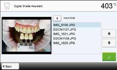 5.7 Funzione Digital Shade Assistant (DSA) Il forno Programat P710 dispone di una funzione per la determinazione del colore dentale sulla base di tre denti di riferimento selezionati.