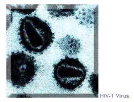 Rafts lipidici INFEZIONE DA HIV 1 http://en.wikipedia.org/wiki/hiv HIV is different in structure from other retroviruses.