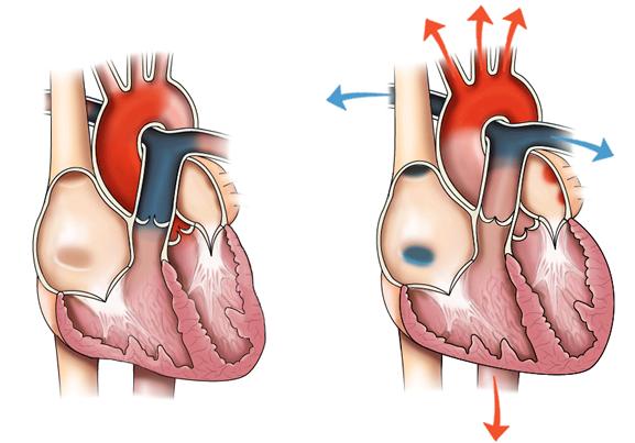 [L apparato Cardiovascolare e la Circolazione Sanguigna] a cura di Tatiana Vantaggio Il tronco polmonare si biforca nelle arterie polmonari destra e sinistra, che portano il sangue ai polmoni.