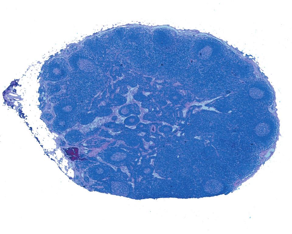 CAPITOLO 1 Introduzione al sistema immunitario A Follicolo (area B) Seno sottocapsulare Antigene Venula a endotelio alto (HEV) Vaso linfatico afferente Trabecula Trabecola Area T Midollo Centro