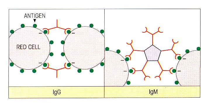 Reazione di_agglutinazione: quando l Ag è corpuscolato: 1- GLOBULI ROSSI 2-