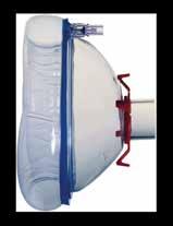 ANESTESIA Maschera per anestesia CRYSTAL TM Si adatta perfettamente al viso del paziente ottimizzando la somministrazione dell anestetico PVC senza ftalati e BPA Alta