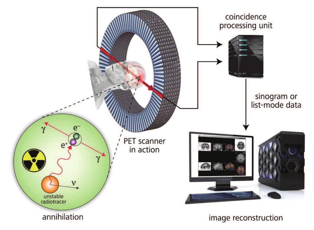 CAPITOLO 2. MONITORING DELL ADROTERAPIA 49 Figura 2.1: Schematizzazione del funzionamento della PET.