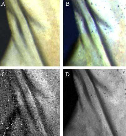 dettaglio busto: A) RGB visibile, B) RGB