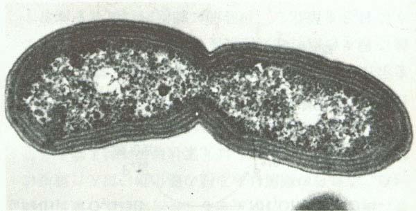 Batteri Ammonio-Ossidanti: Bacilli, sferici, spirilli o lobati, Gram-negativi.