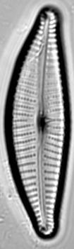 Cymbella turgidula.