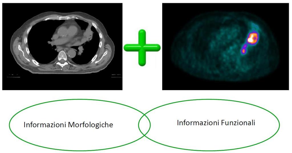 Co-registrazione TC-PET BTV (Biological Target