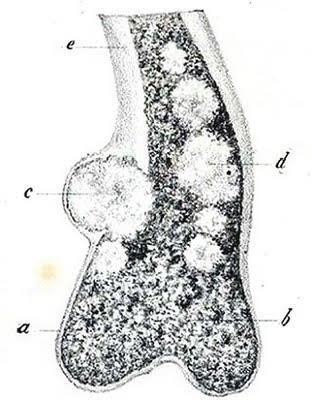 La molteplicità degli encondromi è espressione di una displasia generalizzata del mesoderma la cui causa è sconosciuta Uno dei meccanismi patogenetici chiamati in causa per spiegare la possibile