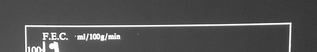 Fattori di rischio non modificabili per l ictus aterosclerotico L