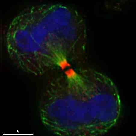 cellule figlie cromatina microtubuli Anello