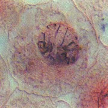 3 Profase Nella profase cromosomi si rendono visibili come filamenti larghi e spessi. Ciascuno è formato da una coppia di cromatidi che rimane Fig.