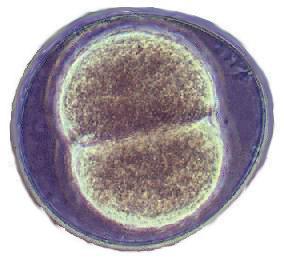 La cellula La cellula è la più piccola unità di un organismo in grado di