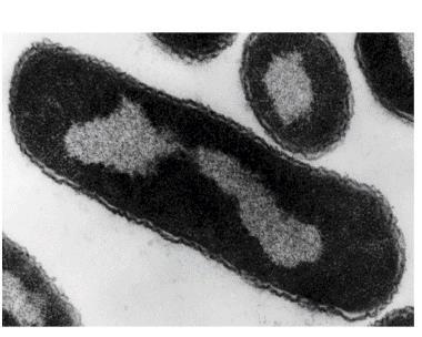 Il procariota: - non ha organuli cellulari specializzati - non ha sistema membranoso interno - no membrana limitante