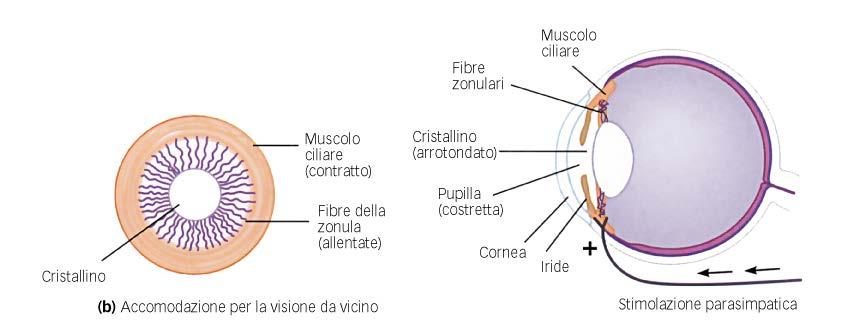 VISIONE DI OGGETTI VICINI: cristallino arrotondato, massimo potere rifrattivo.