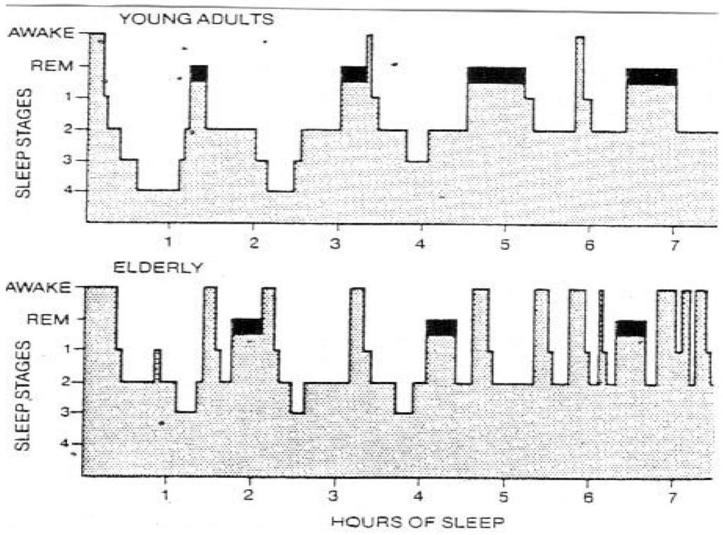 e poi procede a grande ampiezza e frequenza più lenta con onde definite onde delta, cioè la Fase 3 e 4 nonrem. Le ultime due fasi sono classificate come il sonno ad onde lente (SWS) (8).