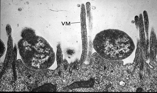 E.coli Enteroemorragici (EHEC) VTEC Associati a gravi patologie nell uomo (BD, SEU) Lesioni Attaching/Effacing VTEC differenti sierotipi