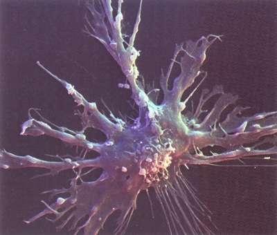 Cellule dendritiche (b) (e gli stessi macrofagi): cattura e processazione di Ag, migrazione verso gli organi linfoidi e presentazione alle cellule della risposta adattativa.