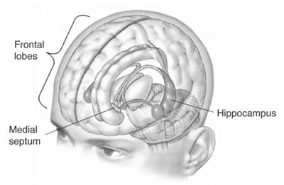 Alcuni importanti contributi '53 H.M. subì l'asportazione dei lobi temporali mediali con un'operazione del chirurgo William Scoville.