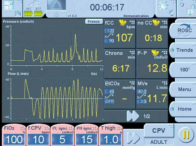 CPV NELLA PRATICA Indicatori essenziali per il massaggio cardiaco durante la CPR Rilevatore di interruzione delle compressioni (no CC) Frequenza (fcc) Parametro critico che riflette l efficacia della