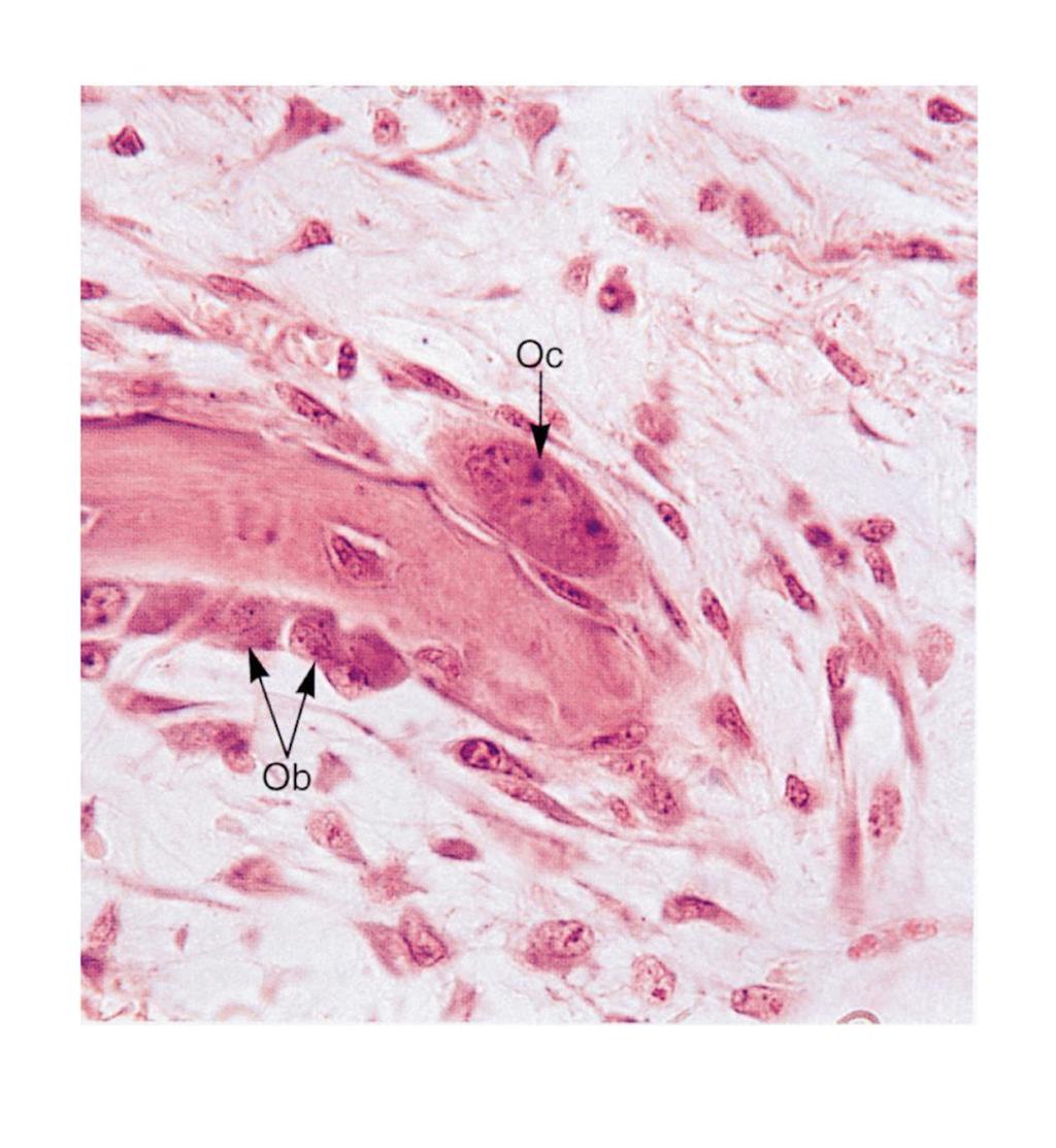 osteoclasta