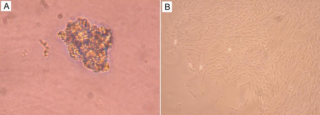 Osteoblasti da cellule staminali: A-STAMINALI; B: OSTEOBLASTI Preparati