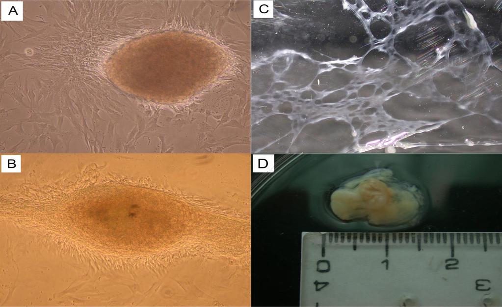 Formazione di osso in vitro da staminali differenziatesi in osteoblasti