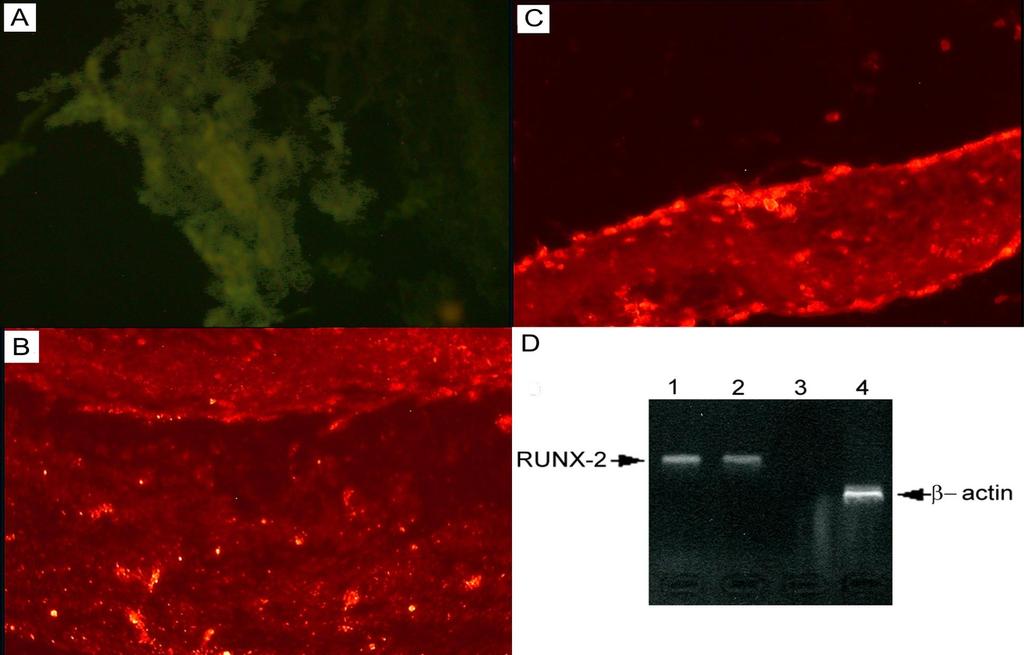 Osso ed osteoblasti in vitro positivi per: BAP, osteocalcina, fibronectina e