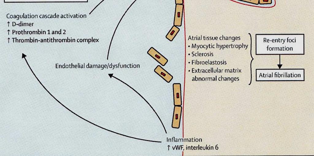 Lancet 2009 Virchow's triad 1855 Anomalie di: parete vaso flusso ematico