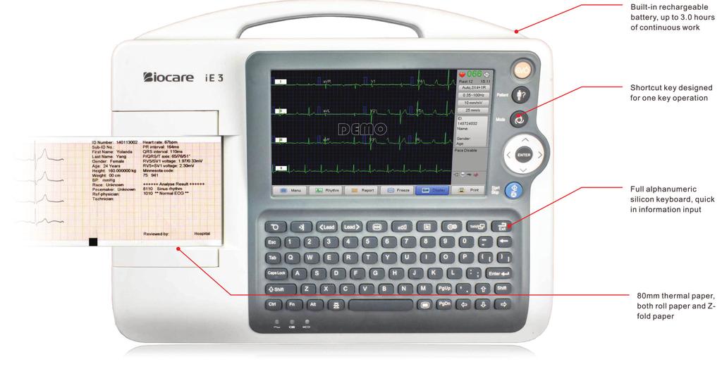 Elettrocardiografo interpretativo 12 derivazioni a 3 canali Batteria ricaricabile con autonomia di 3 ore in utilizzo continuo Pulsanti di accesso rapido alle principali funzioni dell'ecg Tastiera