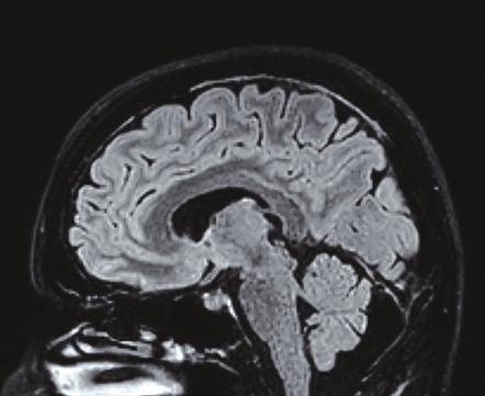 5T Omega, rappresenta il presente e il futuro dell imaging diagnostico. E munita di un magnete in grado di sviluppare un campo magnetico di 1.