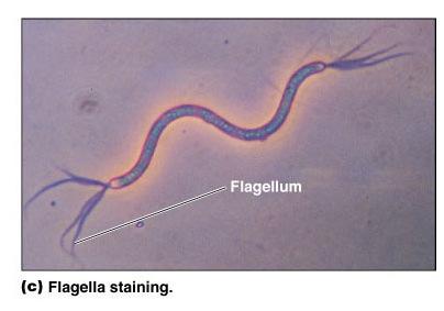 negativa: strutture che non si colorano