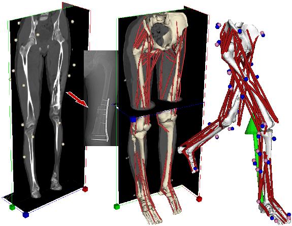 Metodi: modelli numerici modelli muscolo-scheletrici equazioni