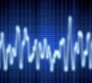 velocities w.r.t. the speed of sound v in the medium.