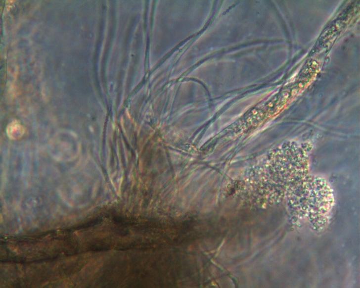 filamentosi e funghi sulla superficie e all interno dei granuli, che ne possono