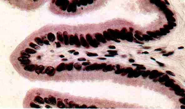 epiglottide Epitelio cilindrico