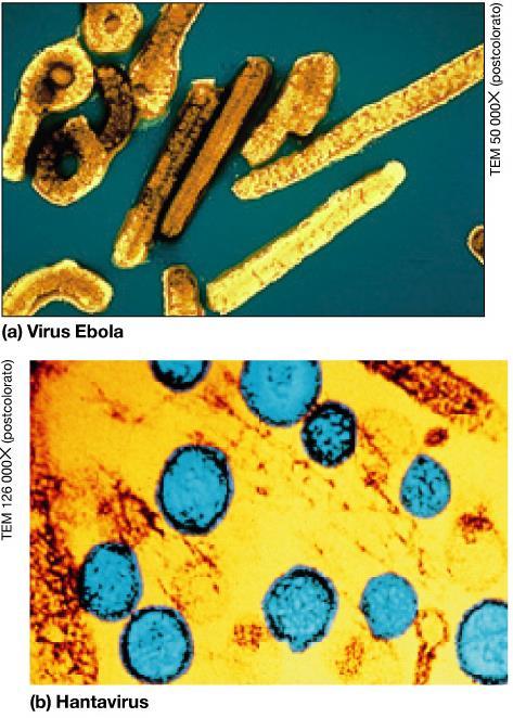 L'ebola è un virus ad RNA appartenente alla famiglia Filoviridae estremamente aggressivo per l'uomo, che causa una febbre emorragica.