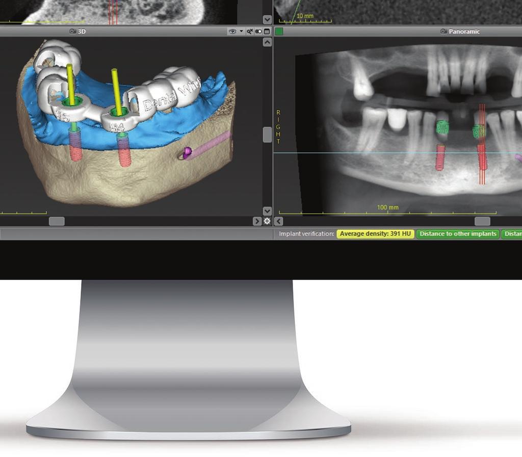 soluzioni CAD / CAM aperte.