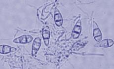 SCELTA DEGLI ISOLATI PER IL BLASTEST a seguito di test