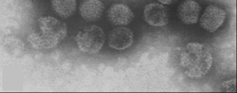 Sprovvisto di envelope L RNA virale codifica per 5 proteine: VP1-90 kd (RNA polimerasi) VP2-41 kd