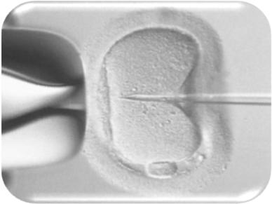 Embrioni da ICSI con seme di scarsa qualità (n174) (<3 mil spermatozoi mobili tot e <4% morfologia normale pre