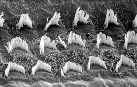 Figura 2 Fotografia la microscopio elettronico di cellule ciliate esterne con stereocilia piegate Stress metabolico Lo stress metabolico risultante dalla sovrastimolazione funzionale gioca il ruolo