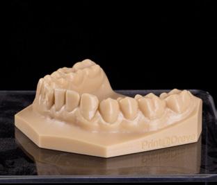 Modello ortodontico mascella