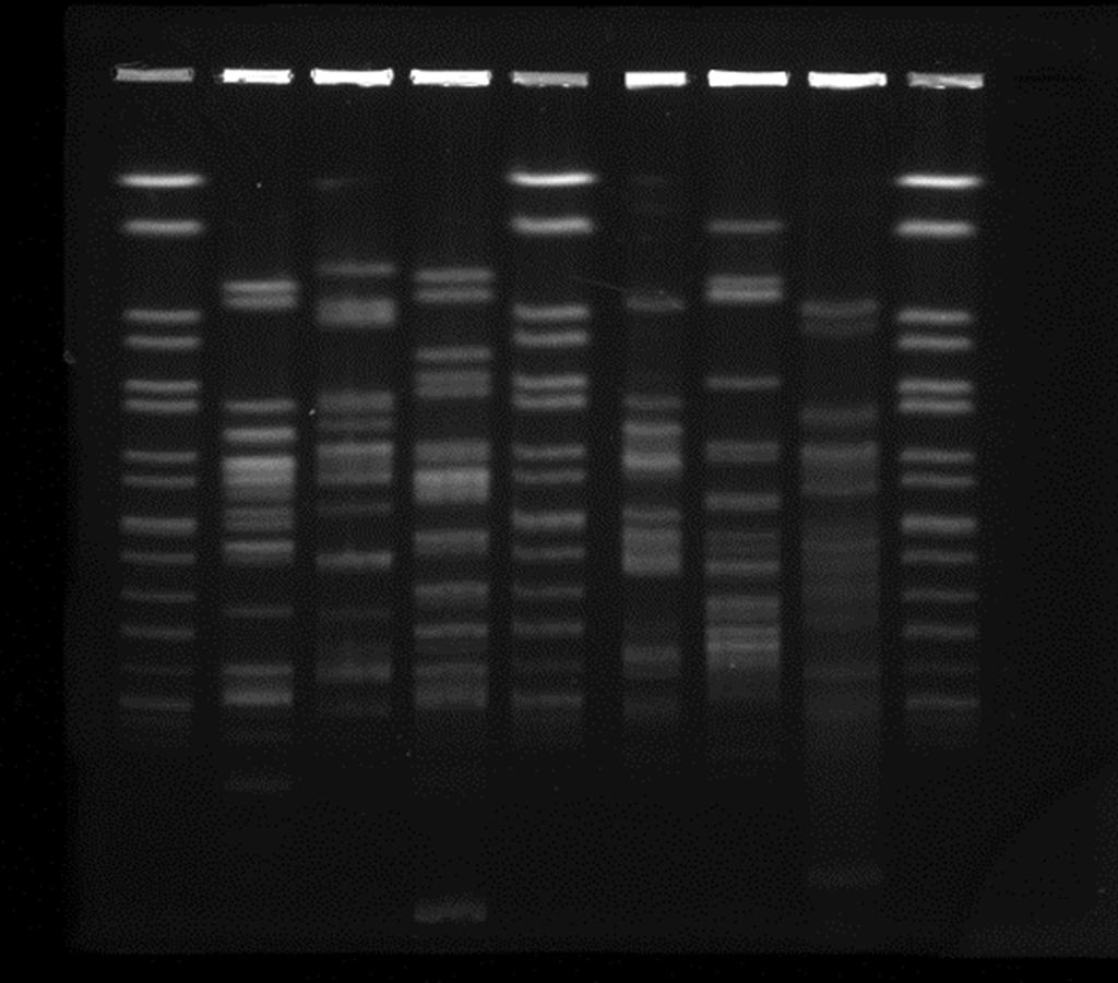 Figura 1. Profili di PFGE dei ceppi di E. coli inclusi nello studio.