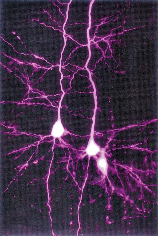 Neurone può