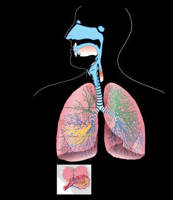 flusso di aria o gas. Tutte le particelle di dimensione inferiore a 10 micron (PM10, ossia 0,01 mm) sono inalabili dagli esseri viventi e quindi possono interessare il sistema respiratorio.