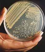 battericide lentamente fungicide virucide superfici, strumenti sporocide Fenoli battericide / senza effetto fungicide virucide (variabile) Cute, mucosa, superfici, strumenti batteriostatico Ossido di